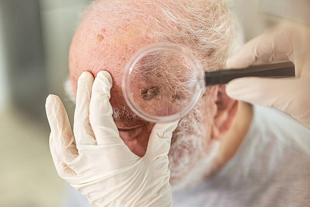 highlight-therapeutics-illuminates-positive-ph.-2-topline-data-in-high-risk-skin-cancer