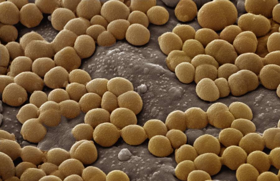 mrsa-exploits-kidney’s-inner-environment-to-persist-and-spread