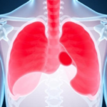 simple-blood-ratio-predicts-survival-in-young-bone-cancer-patients