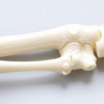 3d-printed-bone-anchored-prosthesis-shows-promise-in-preclinical-tests
