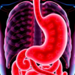 when-gastric-cancer-vanishes-before-surgery:-new-study-maps-who-beats-the-odds