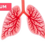 arch-shaped-lung-surgery-preserves-healthy-tissue-in-children-with-congenital-malformations