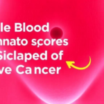 simple-blood-inflammation-scores-may-signal-spread-of-vulvar-cancer