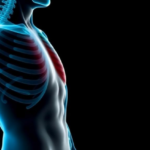 prediabetes-may-quietly-weaken-bone-quality-in-men-even-when-density-looks-normal
