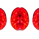 brain-network-scans-reveal-depression-looks-different-in-teenagers-and-adults
