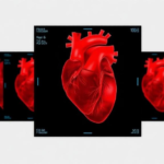 ai-reads-heart-scans-to-predict-who-benefits-most-from-af-ablation