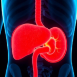 a-simple-staining-test-predicts-early-return-of-colorectal-cancer-after-liver-surgery