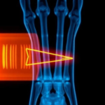x-rays-reveal-how-charging-levels-quietly-reshape-lithium-iron-phosphate-battery-cathodes