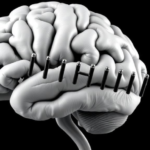ms-severity-gene-variant-also-tied-to-slower-thinking-in-healthy-adults,-uk-biobank-study-finds