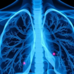tuberculosis-rarely-stays-in-the-lungs,-seven-year-hospital-study-finds