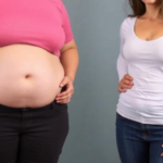 obesity-amplifies-pcos-severity,-but-lean-women-still-face-serious-metabolic-risks