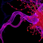 aging-fibroblasts-fuel-ovarian-cancer-growth-through-a-single-secreted-protein