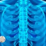 switching-hiv-drugs-or-adding-zoledronic-acid-rebuilds-bone-lost-to-tenofovir
