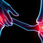 antimicrobial-triclosan-linked-to-joint-damaging-stress-in-new-osteoarthritis-study