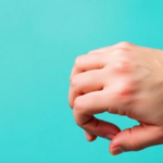 blood-type-offers-no-shield-against-common-skin-warts,-study-finds