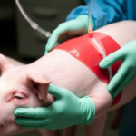 corrected-perfusate-keeps-donor-lungs-viable-through-12-hours-of-ex-vivo-perfusion-in-pigs