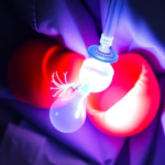 liver-transplants-for-rare-bile-duct-cancer-show-strong-survival-in-australia-and-new-zealand