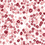 old-fashioned-mitotic-count-may-outperform-ki67-in-hormone-receptor-positive-breast-cancer