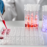 elevated-elabela-levels-distinguish-neonatal-risk-groups-from-controls