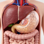 pediatric-hydatid-cyst-mimicked-a-pancreatic-pseudocyst-in-case-report