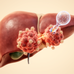 checkpoint-inhibitors-improve-survival-in-pmmr-metastatic-colorectal-cancer-meta-analysis