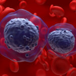 predicting-leukemia-survival-may-be-aided-by-six-gene-scoring-system