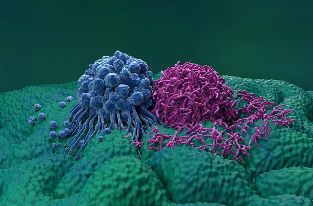spatial-proteomics-for-precision-oncology