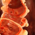 single-cell-multiomics:-phenotypic-plasticity-in-colorectal-cancer-metastasis