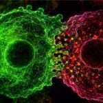 blocking-protein-slows-pancreatic-tumor-growth-and-reduces-immune-suppression-in-mice